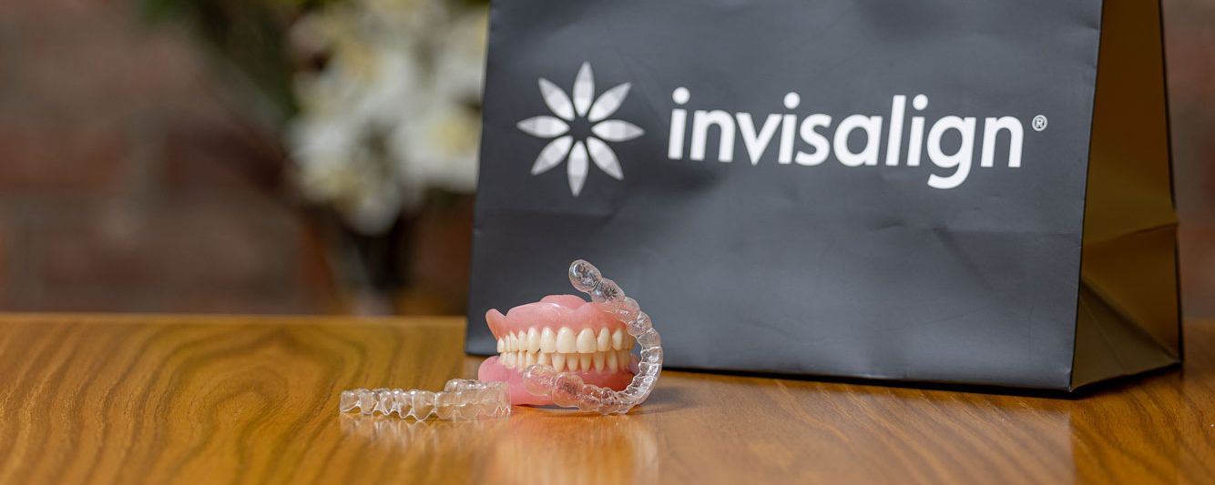 Affordable braces