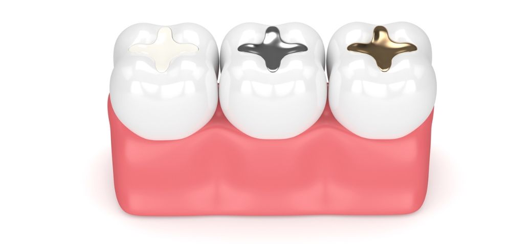 Dental fillings
