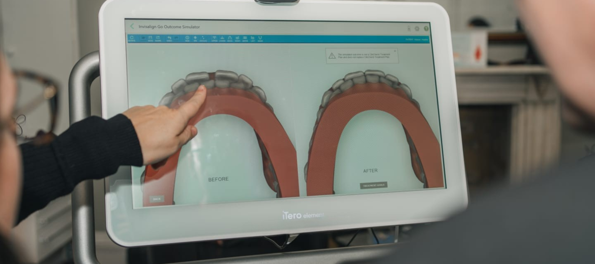 Invisalign
